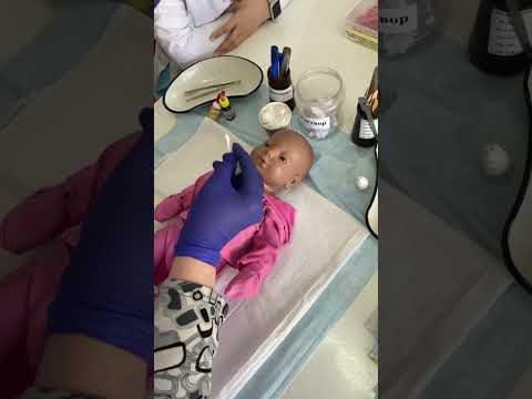 Видео: Алгоритм закапывания капель в уши, в глаз, нос.