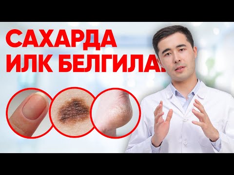 Видео: КАНДЛИ ДИАБЕТ БОШЛАНИШИ | ЯШИРИН БЕЛГИЛАР, КАНДЛИ ДИАБЕТНИ ДАВОЛАШ