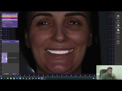 Видео: smile creator. Видео настройке и подгонке фотографии в экзокад