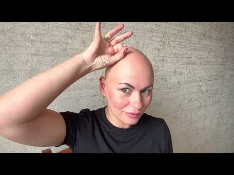 Видео: ЖИВУ С АЛОПЕЦИЕЙ: моя история борьбы и принятия