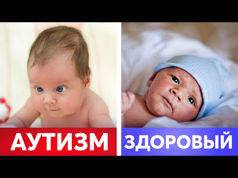 Видео: Ранние признаки АУТИЗМА! Должен знать КАЖДЫЙ РОДИТЕЛЬ!