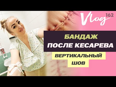 Видео: ЭКО. Как выбрать бандаж после кесарева сечения // Сняли швы