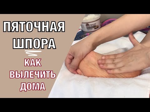 Видео: Пяточная шпора/ плантарный фасциит. Самомассаж + 3 лучших упражнения.