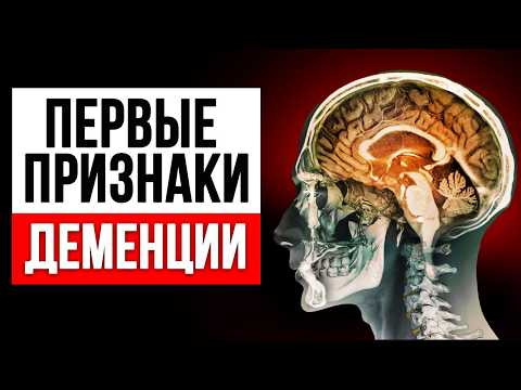 Видео: ДЕМЕНЦИЯ НАЧАЛАСЬ, если человек говорит ЭТУ ФРАЗУ! / Как распознать ранние признаки деменции?