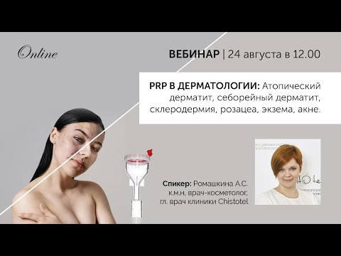 Видео: PRP в дерматологии атопический дерматит себорейный дерматит склеродермия розацеа экзема акне