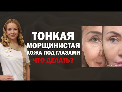 Видео: ТОНКАЯ КОЖА ПОД ГЛАЗАМИ ⁉️😵‍💫МОРЩИНЫ ПОД ГЛАЗАМИ ❓🧐 ЧТО ДЕЛАТЬ ❔