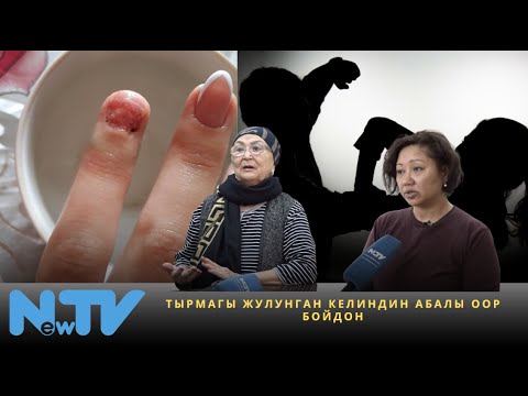 Видео: Тырмагы жулунган келиндин абалы оор бойдон