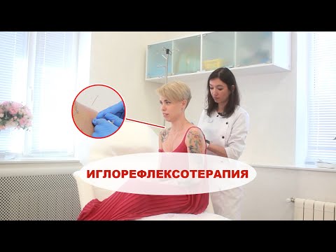 Видео: Иглорефлексотерапия (иглоукалывание)! Что это, какие болезни лечит? Проверено на себе!