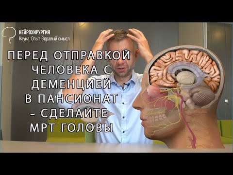 Видео: Что такое гидроцефалия головного мозга?  Cимптомы и диагностика