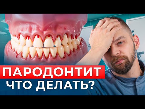 Видео: Пародонтит: как лечить и что делать?