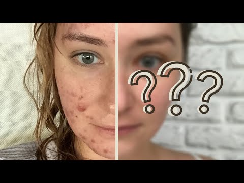 Видео: ДНЕВНИК ПОСТАКНЕ: ВСЁ БЫЛО ТЩЕТНО?