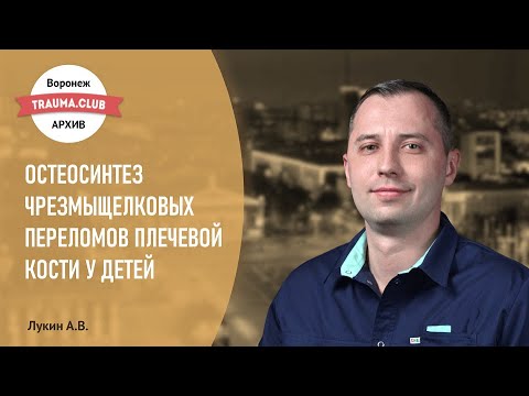 Видео: Остеосинтез чрезмыщелковых переломов плечевой кости у детей