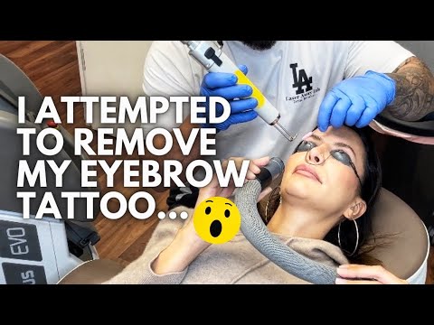 Видео: Мне удалили татуировку бровей | Они стали зелеными...