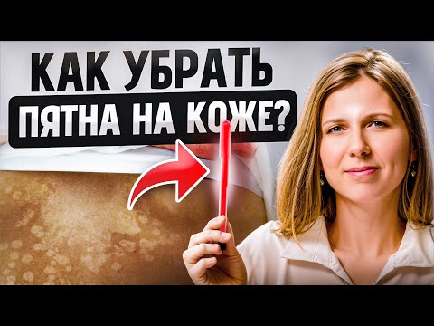 Видео: Мощное средство от ПИГМЕНТАЦИИ вместо дорогих мазей!
