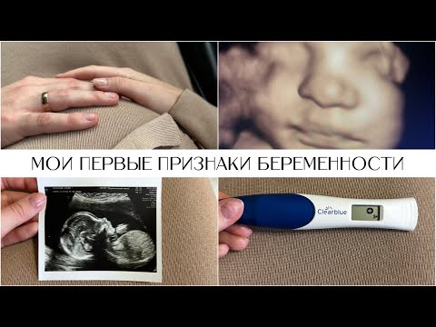 Видео: Мои первые признаки беременности I Реакция мужа I 1 триместр