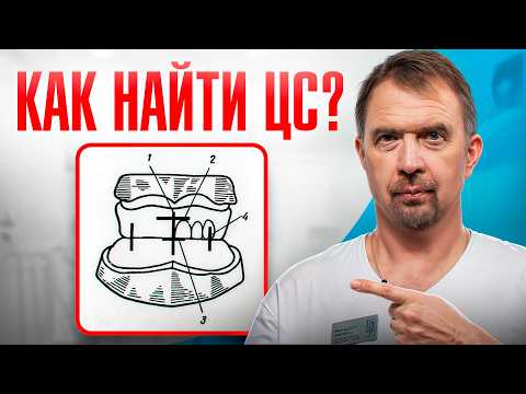 Видео: КАК ОПРЕДЕЛИТЬ ЦЕНТРАЛЬНОЕ СООТНОШЕНИЕ? Полный гайд