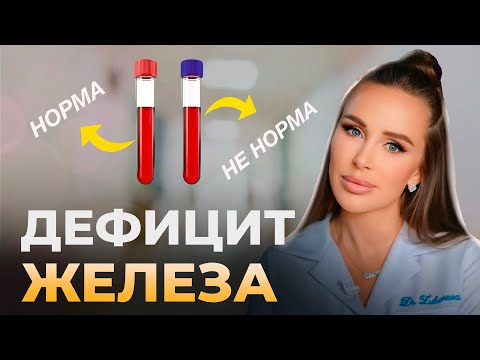 Видео: ЖЕЛЕЗОДЕФИЦИТ: неочевидные причины, о которых важно знать