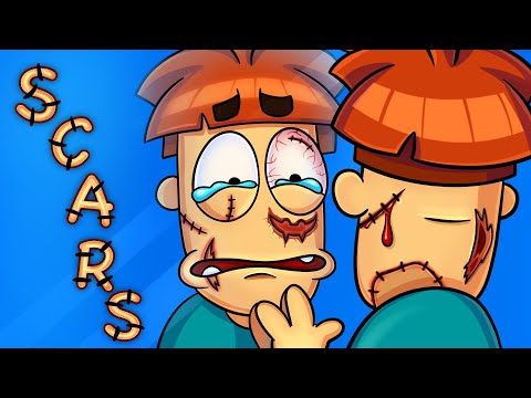 Видео: Які шрами найчастіше зустрічаються на тілі людей?