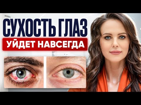 Видео: Убираем синдром сухого глаза за 5 минут! СОВЕТЫ от профессора Шиловой Татьяны