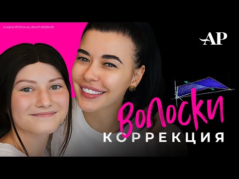 Видео: Алопеция. Коррекция волосков