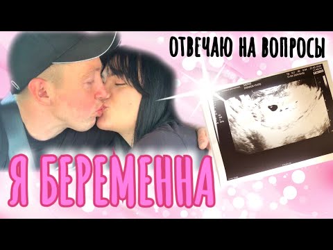 Видео: Я БЕРЕМЕННА. ОТВЕЧАЮ НА ВОПРОСЫ. РЕЗУЛЬТАТ ПЕРВОГО УЗИ. ПОЛОЖИЛИ В БОЛЬНИЦУ😮…