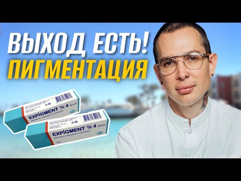 Видео: РЕАЛЬНОЕ УСТРАНЕНИЕ ПИГМЕНТАЦИИ #expigment #пигментныепятна
