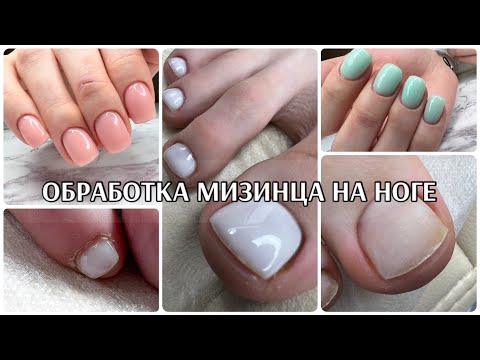 Видео: ОБРАБОТКА МИЗИНЦА НА НОГЕ без ускорения🥰новый формат видео👍 про СЛОЖНОСТИ в работе💗что сделать🥺