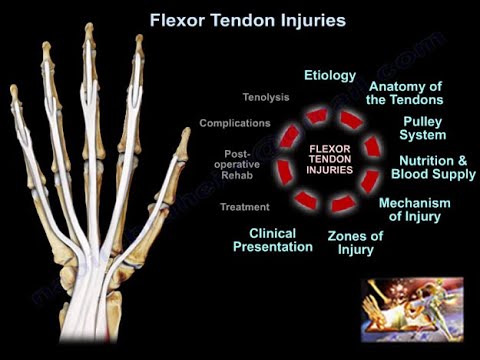 Видео: Травмы сухожилий сгибателей — всё, что вам нужно знать — доктор Набиль Эбрахайм