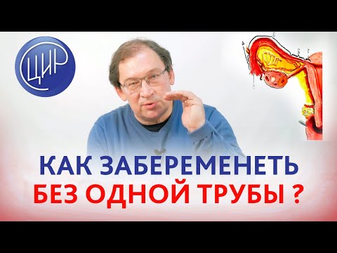 Видео: Беременность  С ОДНОЙ ТРУБОЙ. Как забеременеть, если была внематочная и осталась только 1 труба.