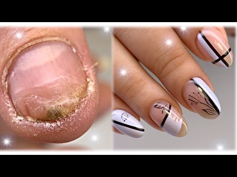 Видео: Скоростная техника маникюра😍Секрет тонких линий💅Травмированные ногти💅Nail art