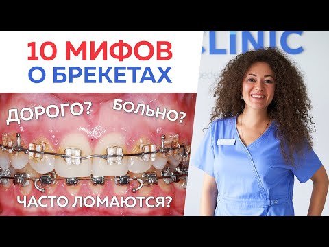 Видео: Самые популярные мифы о брекетах и исправлении зубов / Почему люди боятся исправлять зубы брекетами?