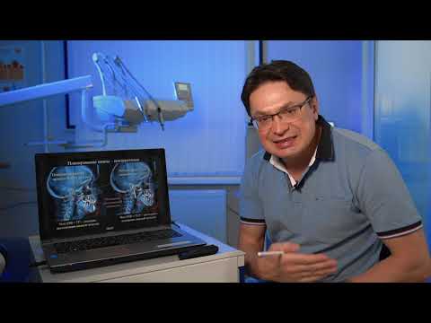 Видео: II часть Тотальное протезирование пациента с двусторонним артрозом ВНЧС