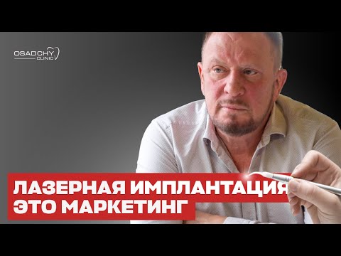 Видео: Лазерная имплантация зубов — это маркетинг