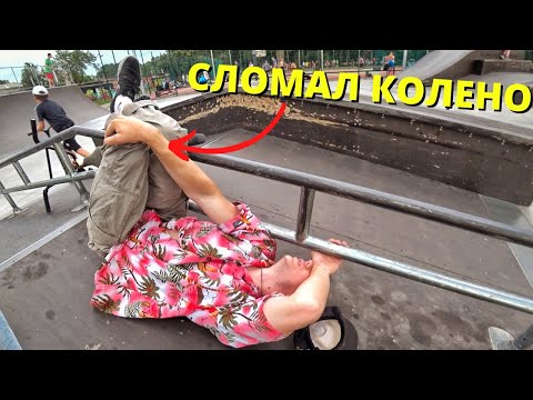 Видео: Я сломал колено на БМХ