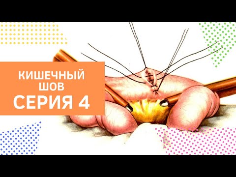 Видео: Серия 4. Кишечный шов