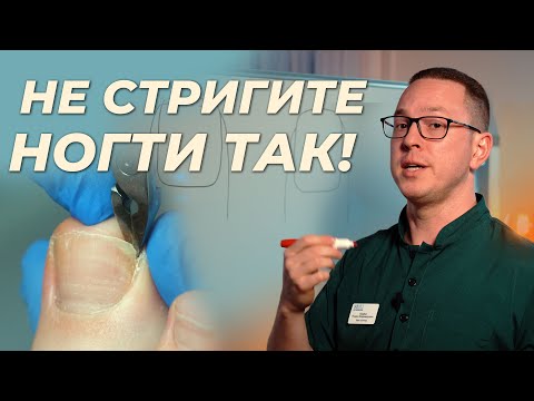 Видео: Как подстригать ногти, чтобы не было проблем