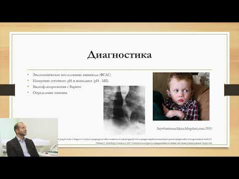 Видео: Абрамов О.С. Рефлюксная болезнь у детей