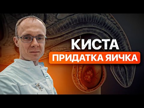 Видео: Киста придатка яичка. Проблемы с зачатием. Врач уролог-андролог. Москва.