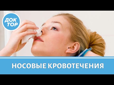 Видео: Когда при кровотечении из носа нужно срочно вызывать скорую
