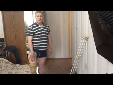 Видео: Неравная борьба Олега Шарапатюка за протез