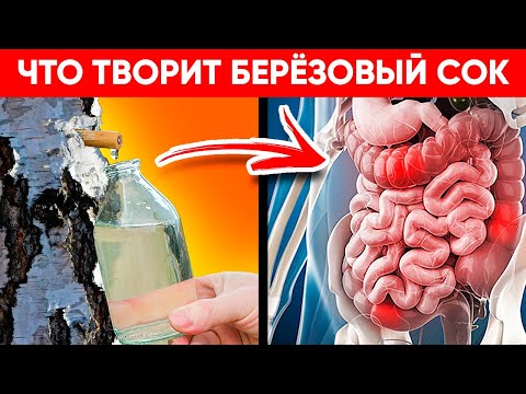 Видео: ВОТ ЧТО ТВОРИТ БЕРЕЗОВЫЙ СОК! (Реальная Польза и Вред Сока Березы)