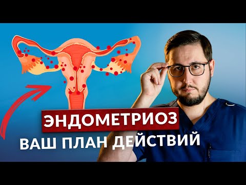 Видео: Что делать если вам поставили диагноз ЭНДОМЕТРИОЗ?