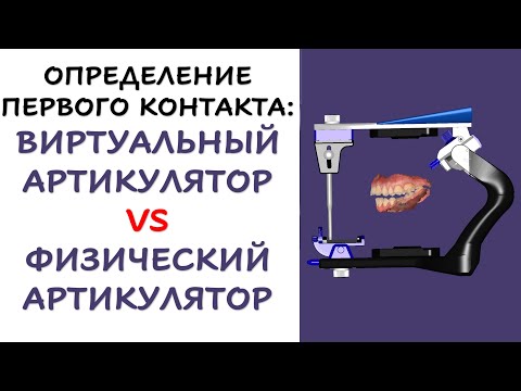 Видео: Функциональный протокол определения первого контакта в артикуляторе: Цифровой VS Мануальный