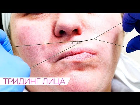 Видео: Удаляем волосы на лице с помощью НИТКИ \ Тридинг лица