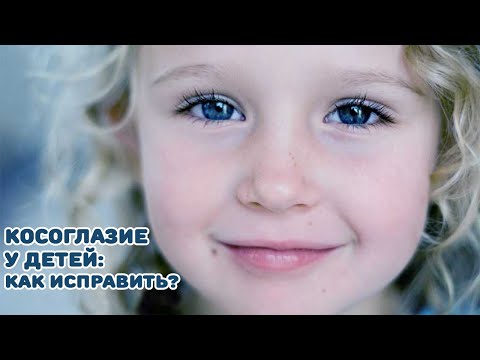 Видео: Косоглазие у детей -  как исправить?