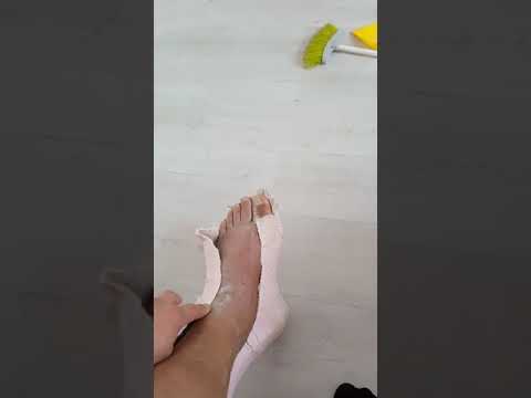 Видео: Снял  гипс раньше срока на 2 недели..