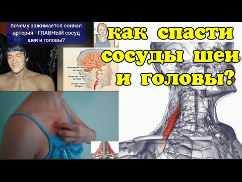 Видео: Задняя лестничная мышца ЗАЖИМАЕТ главный сосуд шеи и мозга. Методы декомпрессии