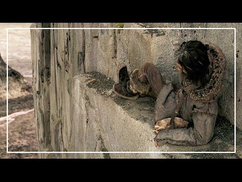 Видео: ҰЙҚЫДАН ТҰРСА, ЖАРТАСТА ЖАТЫР, АЯҒЫ СЫНҒАН