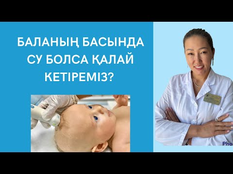 Видео: УЗИда баланың басында су болса қалай кетіреміз?