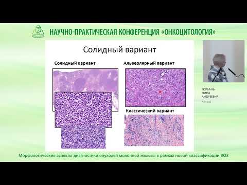 Видео: Морфологические аспекты диагностики опухолей молочной железы в рамках новой классификации ВОЗ